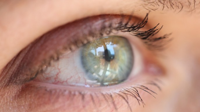 Cheratite: cos’è, i sintomi, come curarla