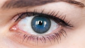 Cheratocono: cos’è, sintomi, come trattarlo