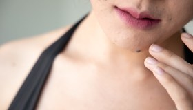 Cisti cutanee: cosa sono, cause e rimedi