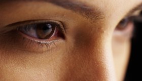 Congiuntivite batterica: cause, sintomi e cure