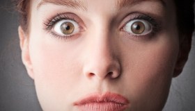 Esoftalmo: che cos’è, sintomi e cura