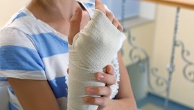 Frattura scomposta: cos’è e come si cura