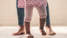 Ginocchio valgo: cause, sintomi, cura