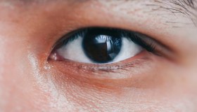 Iridociclite: cos’è, cause, sintomi, cura