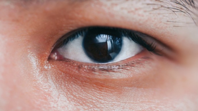 Iridociclite: cos’è, cause, sintomi, cura