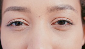 Lagoftalmo: cause, sintomi e cura