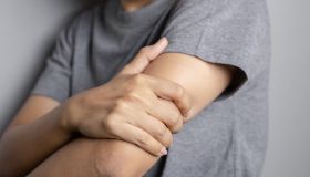 Lupus eritematoso sistemico: sintomi e terapie