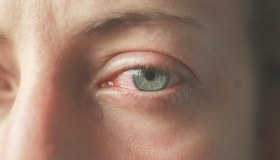 Orzaiolo: cos’è, come riconoscerlo, cura