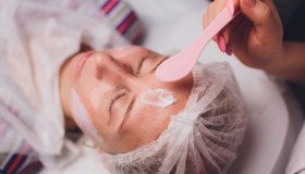 Peeling chimico: cos’è e come funziona