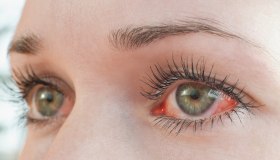 Dry eye al femminile: un aiuto dai sostituti lacrimali e dall’igiene perioculare per combattere l’occhio secco