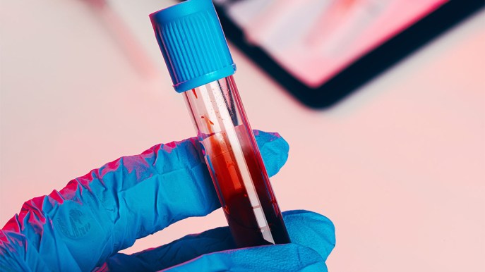 Dieci domande per capire cos’è l’amiloidosi e cosa accade quando colpisce il cuore