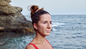 Vitiligine – Conviverci (al meglio), oltre i luoghi comuni